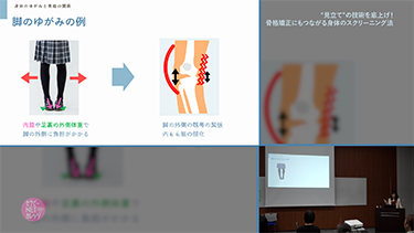 佐々木千紘の“見立て”の技術を底上げ！骨格矯正にもつながる身体のスクリーニング法